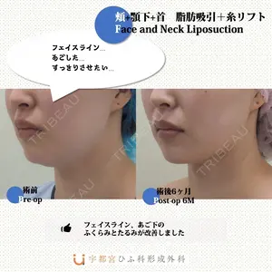 180 days after image