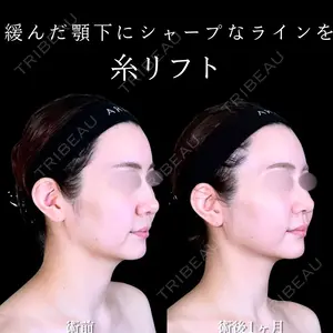 30 days after image