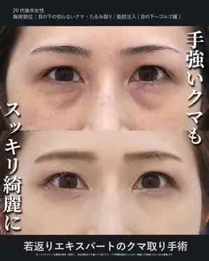 180 days after image