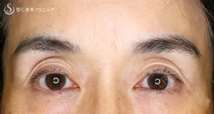 null days after image