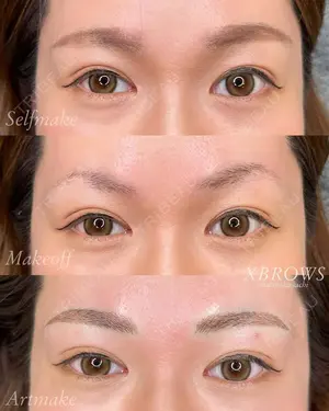 null days after image