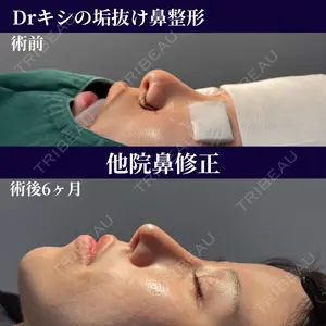 180 days after image