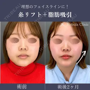 null days after image