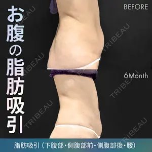 180 days after image