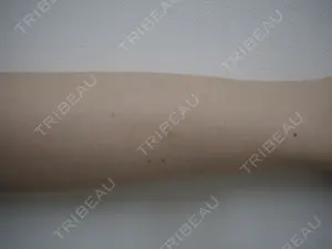 null days after image