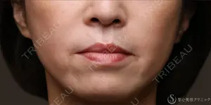 300 days after image