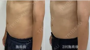 null days after image