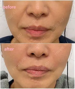 null days after image