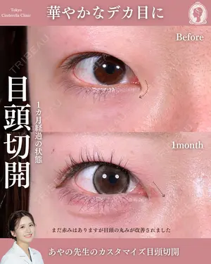 null days after image