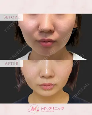 30 days after image