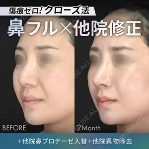 null days after image