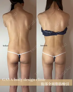 null days after image