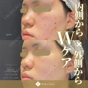 null days after image