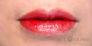 null days after image