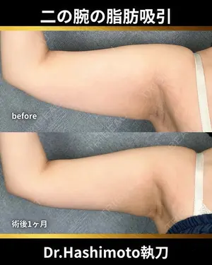 null days after image