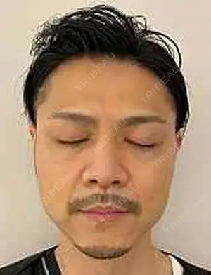 before image