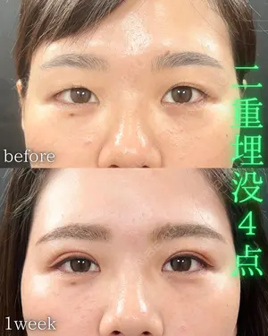 null days after image