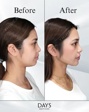 null days after image