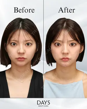 null days after image