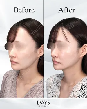 null days after image