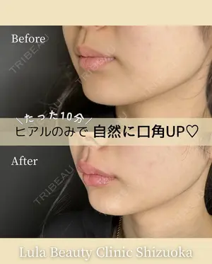 null days after image