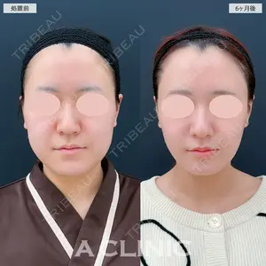 180 days after image