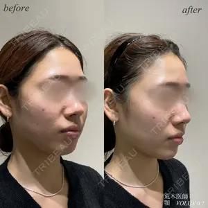 null days after image