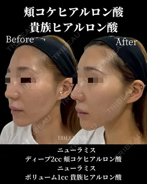 null days after image