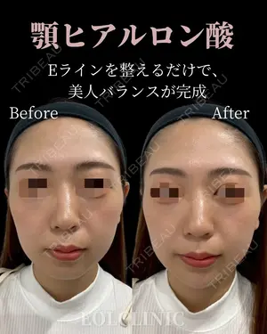 null days after image