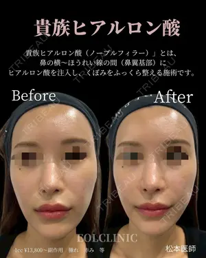 null days after image