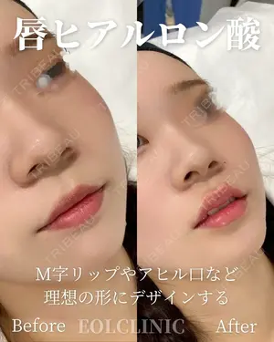 null days after image