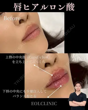 null days after image