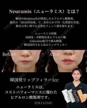 null days after image