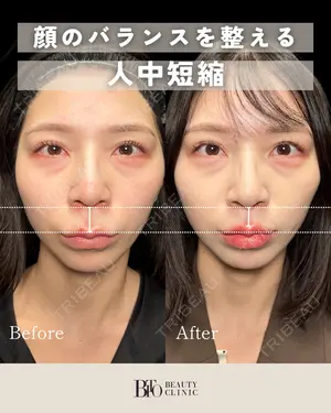 null days after image