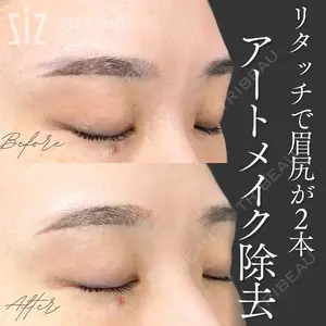 null days after image