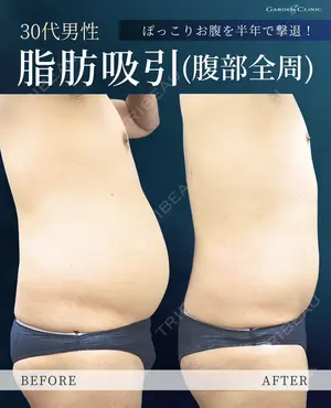 null days after image