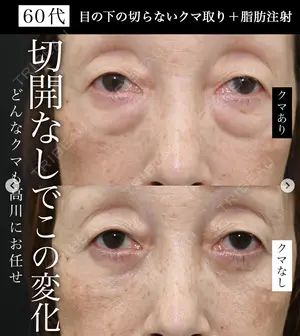 null days after image