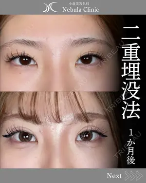 30 days after image