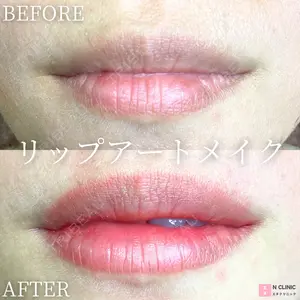 null days after image