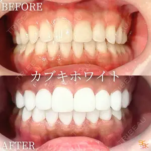 null days after image