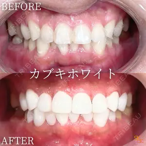 null days after image