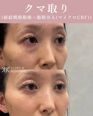 null days after image