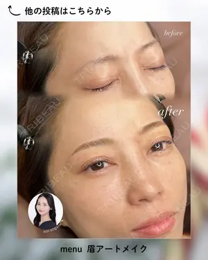 null days after image