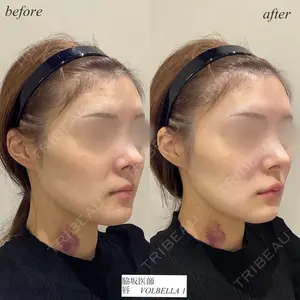 null days after image