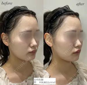 null days after image