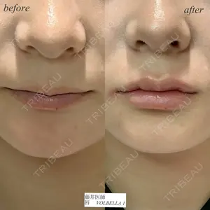 null days after image