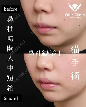 180 days after image