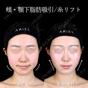 180 days after image