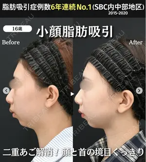 null days after image