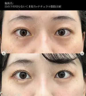 null days after image